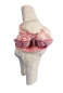Preview: Knie-Implantat-Modell