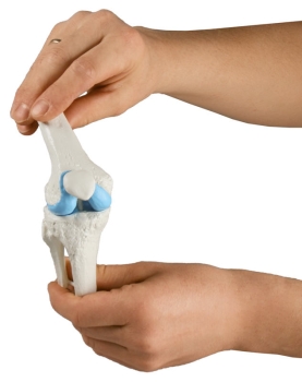 Knie-Implantat-Modell