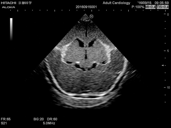 Neonatales Ultraschall-Übungsphantom Kopf